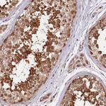 NEDD1 Antibody in Immunohistochemistry (Paraffin) (IHC (P))