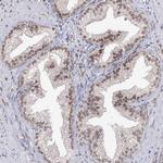 VGLL4 Antibody in Immunohistochemistry (Paraffin) (IHC (P))