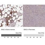 BIN2 Antibody in Immunohistochemistry (IHC)