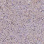 BIN2 Antibody in Immunohistochemistry (IHC)