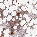 BIN2 Antibody in Immunohistochemistry (IHC)