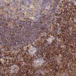 BIN2 Antibody in Immunohistochemistry (IHC)