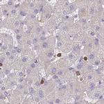 BIN2 Antibody in Immunohistochemistry (IHC)