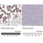 BIN2 Antibody in Immunohistochemistry (IHC)