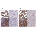 BIN2 Antibody in Immunohistochemistry (IHC)