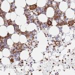 BIN2 Antibody in Immunohistochemistry (IHC)