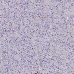 BIN2 Antibody in Immunohistochemistry (IHC)