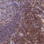 BIN2 Antibody in Immunohistochemistry (IHC)