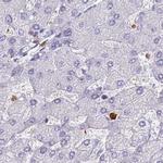 BIN2 Antibody in Immunohistochemistry (IHC)