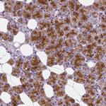 EFCAB4B Antibody in Immunohistochemistry (IHC)