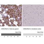 EFCAB4B Antibody