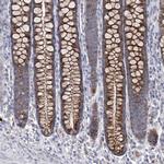 ORP5 Antibody in Immunohistochemistry (Paraffin) (IHC (P))