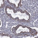 ORP5 Antibody in Immunohistochemistry (Paraffin) (IHC (P))