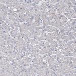 ORP5 Antibody in Immunohistochemistry (Paraffin) (IHC (P))