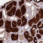 RBP5 Antibody in Immunohistochemistry (Paraffin) (IHC (P))