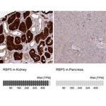 RBP5 Antibody in Immunohistochemistry (IHC)