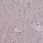 RBP5 Antibody in Immunohistochemistry (IHC)