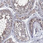 EYA4 Antibody in Immunohistochemistry (Paraffin) (IHC (P))