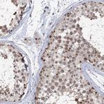 PHF8 Antibody in Immunohistochemistry (Paraffin) (IHC (P))