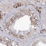 NAGLU Antibody in Immunohistochemistry (Paraffin) (IHC (P))