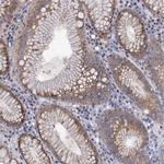 MID1IP1 Antibody in Immunohistochemistry (Paraffin) (IHC (P))