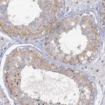 MID1IP1 Antibody in Immunohistochemistry (Paraffin) (IHC (P))