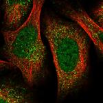 UBR1 Antibody in Immunocytochemistry (ICC/IF)