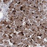 UBR1 Antibody in Immunohistochemistry (Paraffin) (IHC (P))