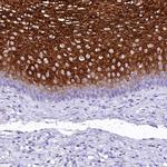 A2ML1 Antibody in Immunohistochemistry (IHC)