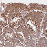 HDC Antibody in Immunohistochemistry (IHC)