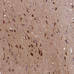 HDC Antibody in Immunohistochemistry (IHC)