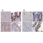 PPHLN1 Antibody in Immunohistochemistry (IHC)