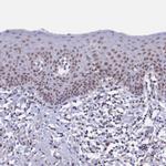 PPHLN1 Antibody in Immunohistochemistry (IHC)