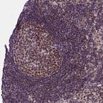 PPHLN1 Antibody in Immunohistochemistry (IHC)