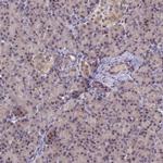 PPHLN1 Antibody in Immunohistochemistry (IHC)