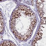 PPHLN1 Antibody in Immunohistochemistry (IHC)