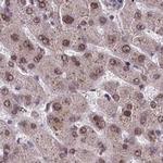 PPHLN1 Antibody in Immunohistochemistry (IHC)