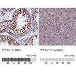 PPHLN1 Antibody