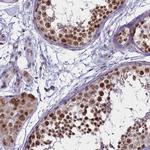 PPHLN1 Antibody in Immunohistochemistry (IHC)