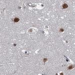 PPHLN1 Antibody in Immunohistochemistry (IHC)