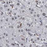 PPHLN1 Antibody in Immunohistochemistry (IHC)