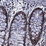 PPHLN1 Antibody in Immunohistochemistry (IHC)