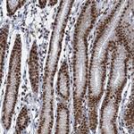 PPHLN1 Antibody in Immunohistochemistry (IHC)