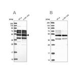 PPHLN1 Antibody in Western Blot (WB)