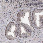 FAM48A Antibody in Immunohistochemistry (Paraffin) (IHC (P))