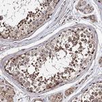 FAM48A Antibody in Immunohistochemistry (Paraffin) (IHC (P))