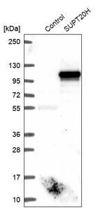 FAM48A Antibody in Western Blot (WB)