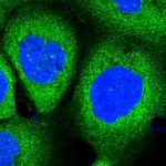 PACS1 Antibody in Immunocytochemistry (ICC/IF)