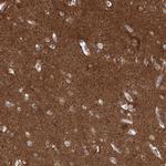 PACS1 Antibody in Immunohistochemistry (IHC)