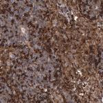 PACS1 Antibody in Immunohistochemistry (IHC)